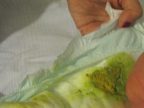 Sgabelli verdi nell'allattamento al seno dei bambini