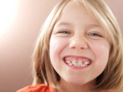 Borden voor het uitlijnen van tanden bij kinderen