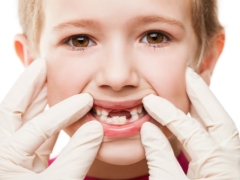Frequente problemen met tandvlees bij kinderen