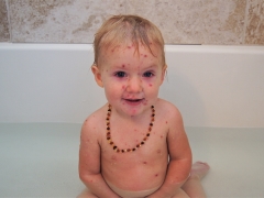 È possibile fare il bagno a un bambino con la varicella?