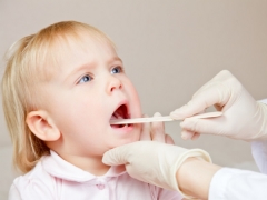Varicella nella bocca di un bambino