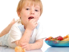 اتباع نظام غذائي في الأطفال مع جدري الماء