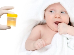 Kyselina askorbová v moči dieťaťa