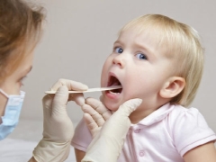 Sintomi e trattamento della tonsillite purulenta nei bambini a casa
