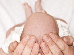 What if the baby has dry scalp?