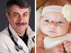 Dr. Komarovsky o hemangiomu u novorođenčadi
