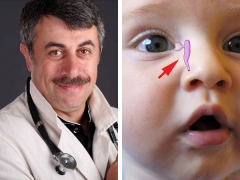 Dr. Komarovsky sa massage ng lacrimal canal sa newborns