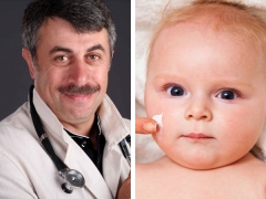 Dr. Komarovsky over de oorzaken van een droge huid bij een kind
