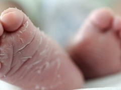 신생아의 피부가 벗겨지면 어떻게해야합니까?