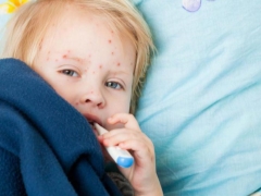 어린이에게서 엔테로 바이러스 감염 발진이 보이는 것은 무엇입니까?