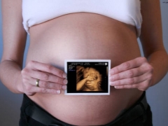 3D-ultraljud under graviditeten
