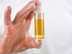 Proteína na urina durante a gravidez: normas e causas de desvios