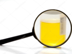 Ce trebuie făcut dacă sarea este detectată în urină în timpul sarcinii?