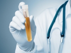 Erytrocyten in de urine tijdens de zwangerschap en de oorzaken van bloed in de urine