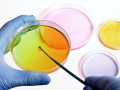 Cum să treci și să descifrăți cultura urinară bacteriologică în timpul sarcinii?