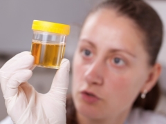 Leveringsvoorwaarden voor urine-analyse tijdens de zwangerschap