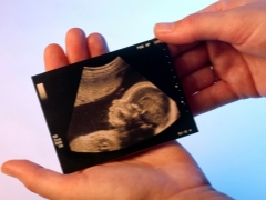 Ultraljud i den 12: e veckan av graviditeten: fostrets storlek och andra egenskaper