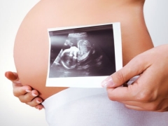 Ultraljud i den 22: e veckan av graviditeten: fostrets storlek och andra funktioner