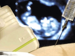 Varför gör amniocentes under graviditeten och vad visar den?