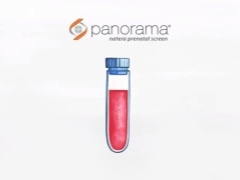 Varför testar de Panorama under graviditeten och vad är recensionerna om det?