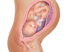 자궁의 전벽에 태반이 무엇을 의미하고 무엇이 영향을 미치나요?