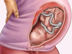 Vad är låg previa under graviditeten och är det farligt?