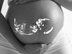 Gebelikte uterusta hematom teşhisi ve tedavisi