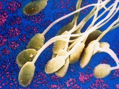 Come sono disposti gli spermatozoi? Le loro caratteristiche, struttura, dimensioni e funzionalità