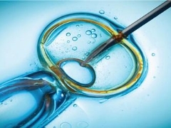 ICSI nedir? - intracytoplasmik sperm enjeksiyonu, prosedür nasıl?