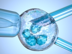 IVF ohne hormonelle Stimulation im natürlichen Zyklus
