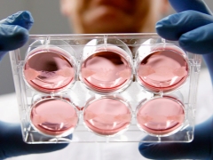 IVF'de embriyo transferi: işlem sonrası özellikler ve duyumlar