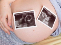 Meerdere zwangerschappen met IVF: van kans op risico