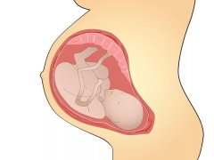 Kısa bir göbek kordonunun gebelik ve doğum üzerindeki etkisinin özellikleri