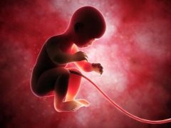 Göbek kordonu bağlantı tipleri ve fetus üzerine etkileri