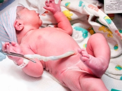 Göbek kordonu hakkında: norm göstergeleri, hamilelik ve görünüm sırasındaki işlev