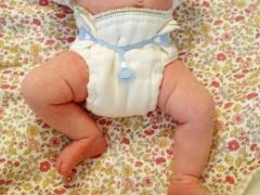 Yeni doğan bebekler için gazlı bez nasıl yapılır?