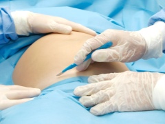 الشفاء بعد الولادة القيصرية