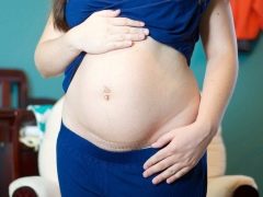 كم شهر يمكنك أن تنجبين طفلاً بعد الولادة القيصرية؟