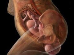 Hur är den vertikala födelsen? Fördelar och nackdelar