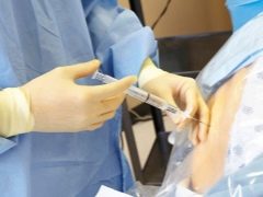 Mogelijke effecten van epidurale anesthesie tijdens de bevalling