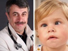 Dr Komarovsky over scheelzien bij kinderen