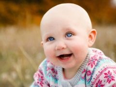 Alopecia בילדים: גורם ושיטות הטיפול