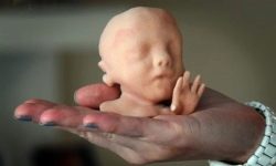 İlk elden bakın: Ufa'da hamile kadınlara hala doğmamış çocuklarının 3D modelini almaları teklif edildi.