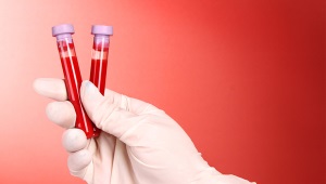 Serologisch bloedonderzoek op hepatitis, HIV, syfilis en andere ziekten