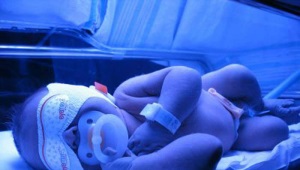 Phototherapy for newborns with jaundice