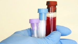 Verminderde neutrofielen in het bloed van een kind