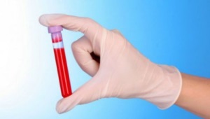 WBC krvný test u detí
