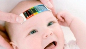 Hidrocefalie - picături de creier la copii
