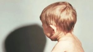 Krivica u dojčiat: príznaky a liečba