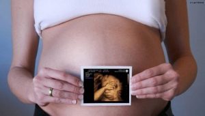 3D-ultraljud under graviditeten